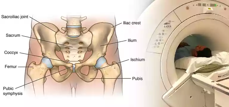 Pelvic MRI: Things you should know